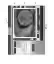 Fig. 46 - Full-eye illumination ocular surface imaging of an ocular tear film for determining tear film thickness and/or providing ocular topography