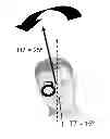 Fig. 01 - Quantifying ocular counter roll