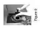 Fig. 10 - Quantifying ocular counter roll