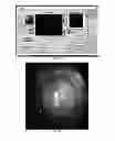 Fig. 15 - Ophthalmic range finding