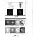 Fig. 17 - Ophthalmic range finding