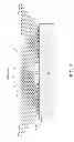 Fig. 04 - Distinguishing foreign surface features from native surface features