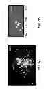 Fig. 10 - Distinguishing foreign surface features from native surface features