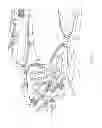 Fig. 15 - Capillary actuator deployment