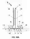 Fig. 16 - Rigid circuit board with flexibly attached module