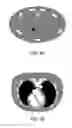 Fig. 08 - X-ray dose estimation technique