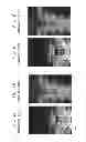 Fig. 06 - X-ray apparatus and method of obtaining X-ray image
