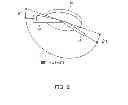 Fig. 03 - X-ray generating apparatus