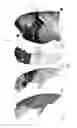 Fig. 07 - Visualization and characterization of pulmonary lobar fissures