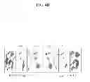 Fig. 06 - Apparatus and method for analyzing medical image