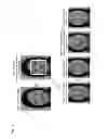 Fig. 12 - Image processing device, information generation device, image processing method, information generation method, control program, and recording medium for identifying facial features of an image based on another image