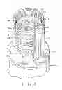 Fig. 07 - PROGRESSIVE CAVITY PUMP