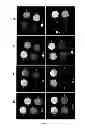 Fig. 09 - Molecules specifically binding pancreatic beta cells biomarkers