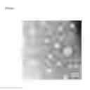 Fig. 04 - THERAPEUTIC NANOEMULSION FORMULATION FOR THE TARGETED DELIVERY OF DOCETAXEL AND METHODS OF MAKING AND USING THE SAME