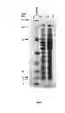 Fig. 02 - Polycistronic expression system for bacteria