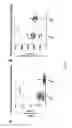 Fig. 02 - BLOCKAGE OF PAI-1 IN DIABETIC CD34+ STEM CELLS CORRECTS CELLULAR DYSFUNCTION