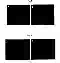Fig. 06 - Method for treating vascular-related disease