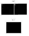 Fig. 07 - Method for treating vascular-related disease