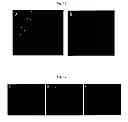 Fig. 09 - Method for treating vascular-related disease