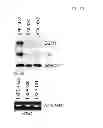 Fig. 20 - Use of Cbl as biomarker for identifying subject suitable for treatment with anti-c-Met antibody