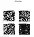 Fig. 44 - Methods of treating autoimmune disease with anti-CD40 antibodies