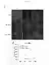 Fig. 08 - Methods for treating prostate cancer