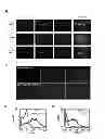 Fig. 12 - Methods for treating prostate cancer