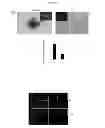 Fig. 15 - Methods for treating prostate cancer