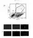 Fig. 16 - Methods for treating prostate cancer