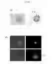 Fig. 17 - Methods for treating prostate cancer