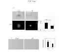 Fig. 19 - Methods for treating prostate cancer