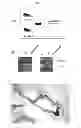 Fig. 20 - Methods for treating prostate cancer