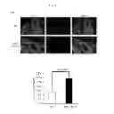 Fig. 23 - Methods for treating prostate cancer