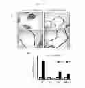 Fig. 28 - Methods for treating prostate cancer