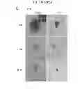Fig. 30 - Methods for treating prostate cancer