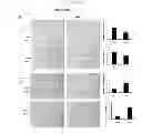 Fig. 34 - Methods for treating prostate cancer