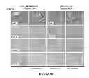 Fig. 03 - Methods for assessing cancer recurrence