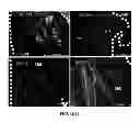 Fig. 11 - HYDROGELS FOR TISSUE REGENERATION