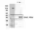 Fig. 23 - Modified polynucleotides encoding aquaporin-5