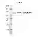 Fig. 26 - Modified polynucleotides encoding aquaporin-5