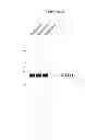 Fig. 33 - Modified polynucleotides encoding aquaporin-5
