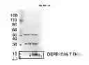 Fig. 48 - Modified polynucleotides encoding aquaporin-5