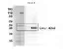 Fig. 23 - Modified polynucleotides encoding copper metabolism (MURR1) domain containing 1