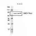 Fig. 26 - Modified polynucleotides encoding copper metabolism (MURR1) domain containing 1