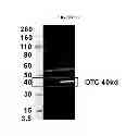 Fig. 31 - Modified polynucleotides encoding copper metabolism (MURR1) domain containing 1