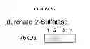 Fig. 59 - Modified polynucleotides encoding copper metabolism (MURR1) domain containing 1