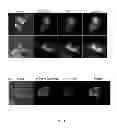 Fig. 03 - HEMOGLOBIN-BASED OXYGEN CARRIER-CONTAINING PHARMACEUTICAL COMPOSITION FOR CANCER TARGETING TREATMENT AND PREVENTION OF CANCER RECURRENCE