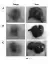 Fig. 19 - HEMOGLOBIN-BASED OXYGEN CARRIER-CONTAINING PHARMACEUTICAL COMPOSITION FOR CANCER TARGETING TREATMENT AND PREVENTION OF CANCER RECURRENCE