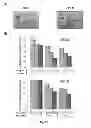 Fig. 28 - HEMOGLOBIN-BASED OXYGEN CARRIER-CONTAINING PHARMACEUTICAL COMPOSITION FOR CANCER TARGETING TREATMENT AND PREVENTION OF CANCER RECURRENCE