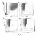 Fig. 31 - HEMOGLOBIN-BASED OXYGEN CARRIER-CONTAINING PHARMACEUTICAL COMPOSITION FOR CANCER TARGETING TREATMENT AND PREVENTION OF CANCER RECURRENCE